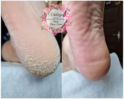 Gabinet Kosmetyczno-Podologiczny "Vintage" Beata Baran-Solecka